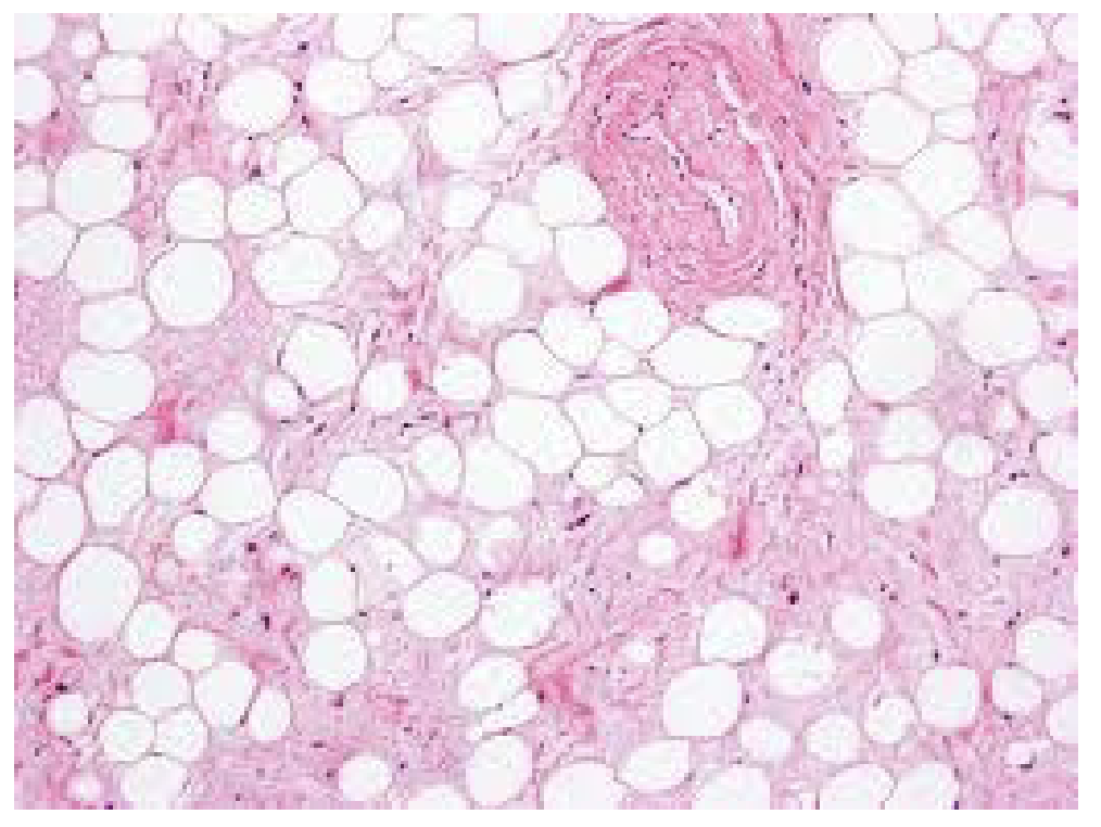 <p>What is this Connective Tissue? and where is it found ?</p>