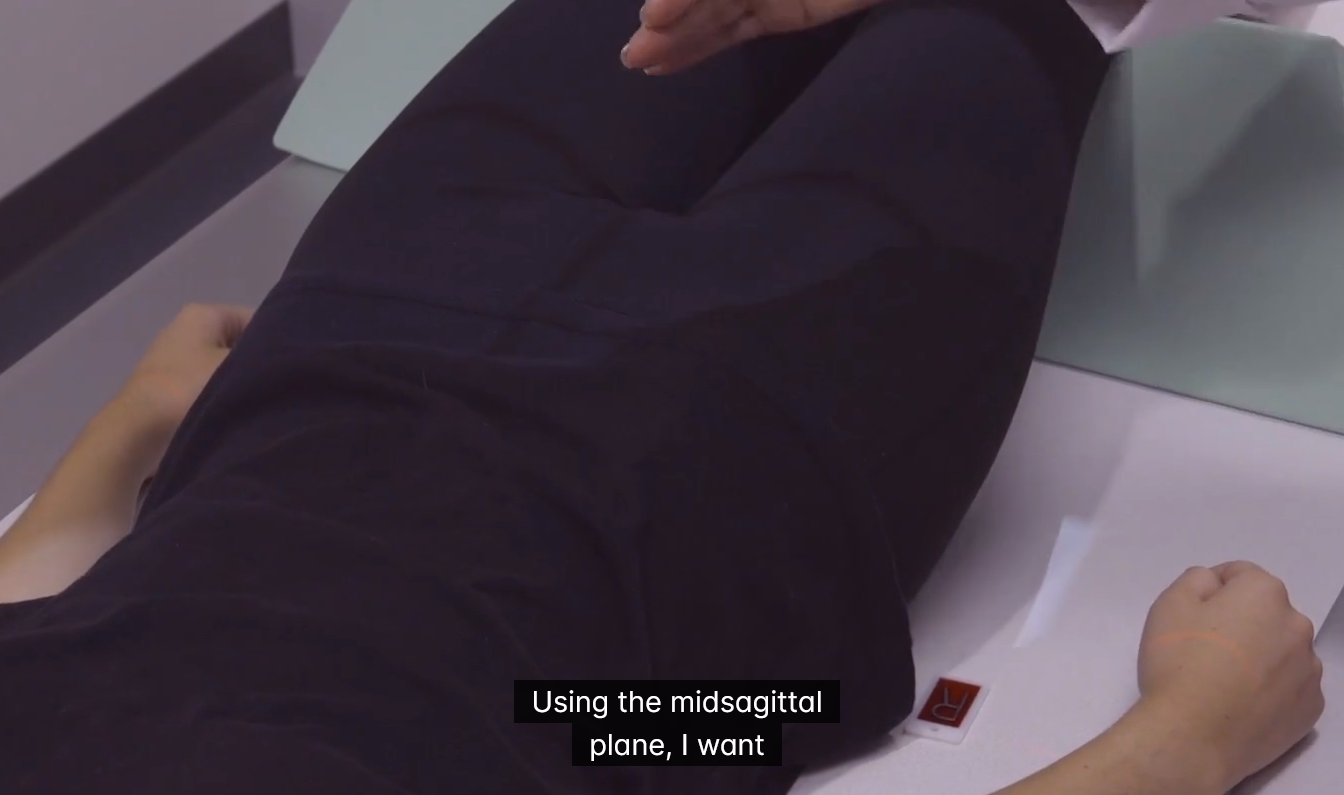 <p>1-2 inches distal to the superior border of the pubic symphysis</p>