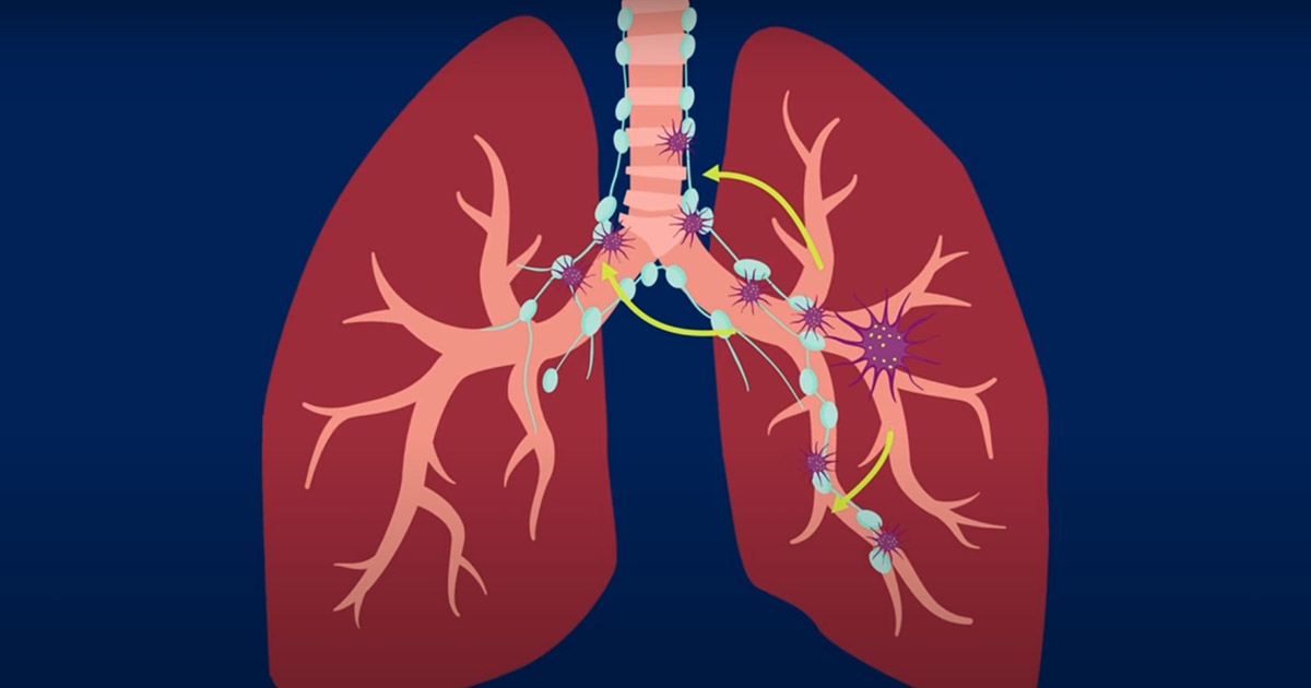 <p>Around the lungs </p>