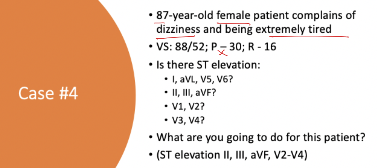 <p>What do t<strong>all, peaked T-waves mimic </strong>in <strong><em>localized tissue injury</em></strong>?</p>