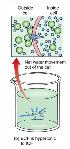 <p>osmolarity of the ECF is greater than the ICF</p><p>Osmotic pressure causes fluid to move out of the cell into the ECF</p><p>Cell shrinks</p>