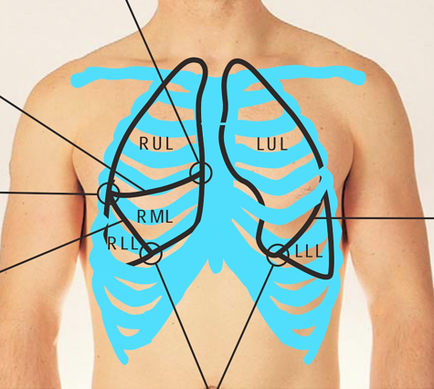 <p>Right</p><ul><li><p>RUL</p></li><li><p>RML</p></li><li><p>RLL</p></li></ul><p>Left</p><ul><li><p>LUL</p></li><li><p>LLL</p></li></ul><p></p>