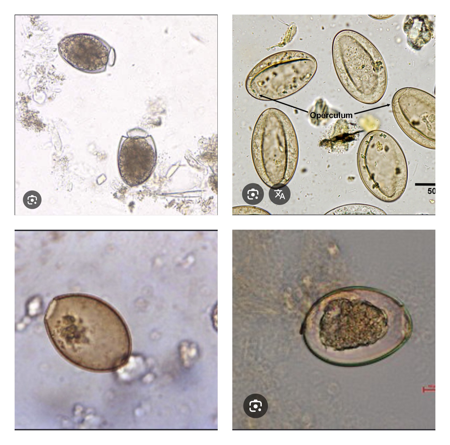 <p>“Fish tapeworm”</p><p>Intermediate host: Fish</p><p>Definitive host: Dogs get infected by eating raw fish</p>