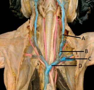 <p><span style="line-height: 17.375px;">Correctly identify the L. subclavian vein.&nbsp;</span></p>
