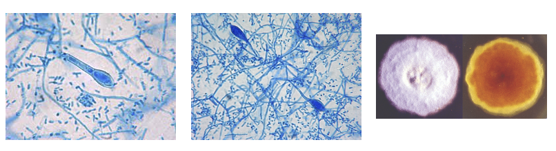 <p>ID this mold </p>