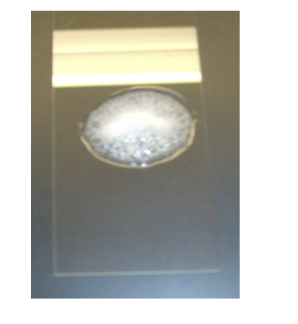 <p>what is the test and result?</p>