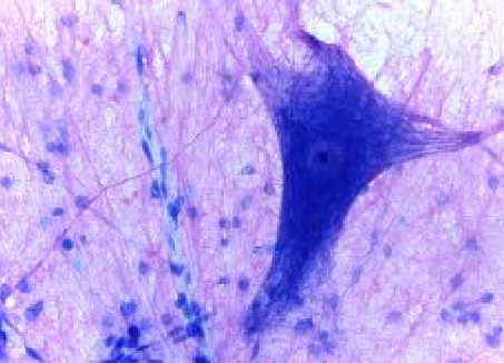 <p>ID Basic Tissue Type</p>