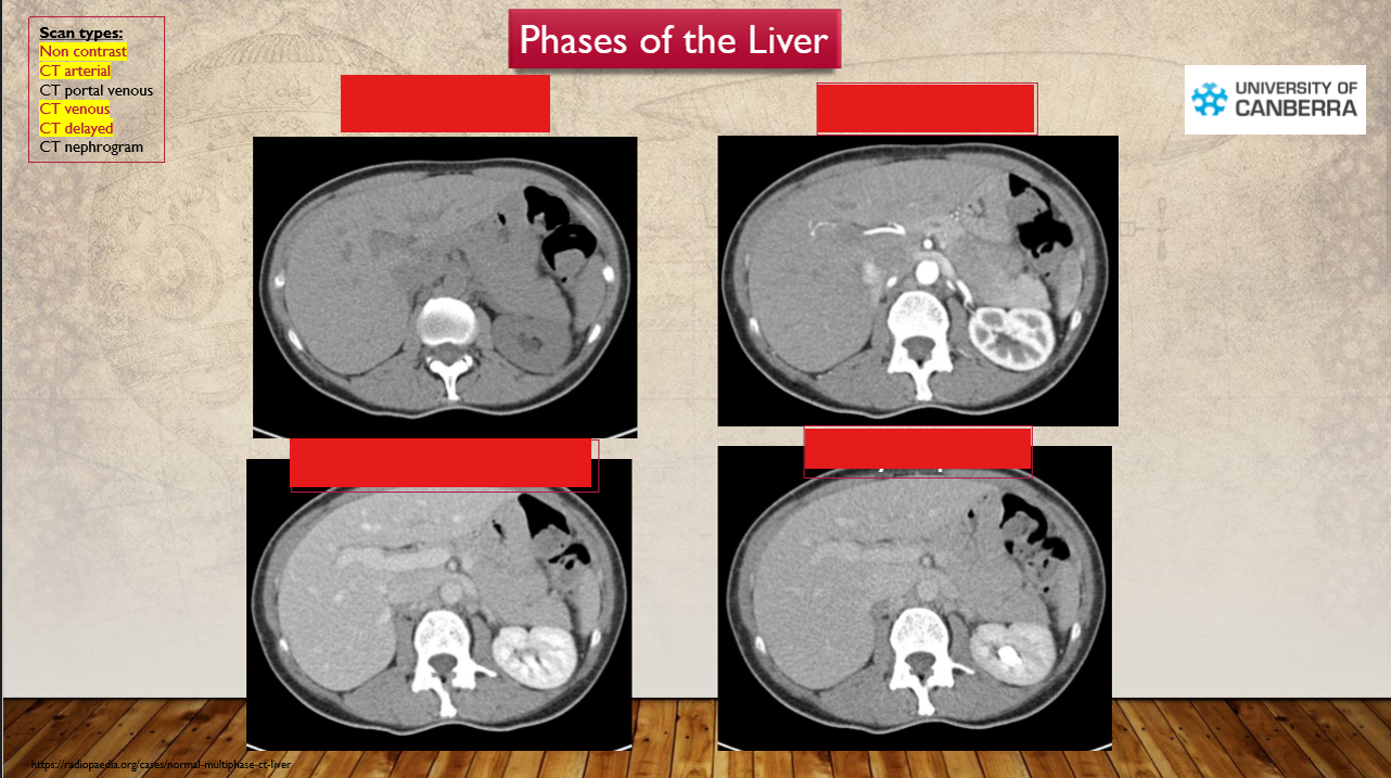 <p>What phases are these liver in</p>