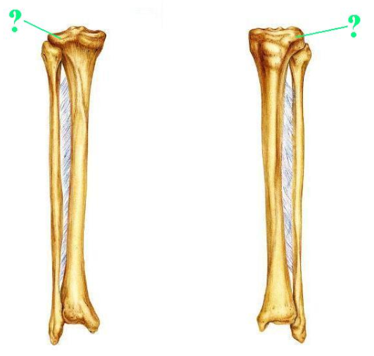 <p><span>Identify the indicated bone marking (projection).</span></p>