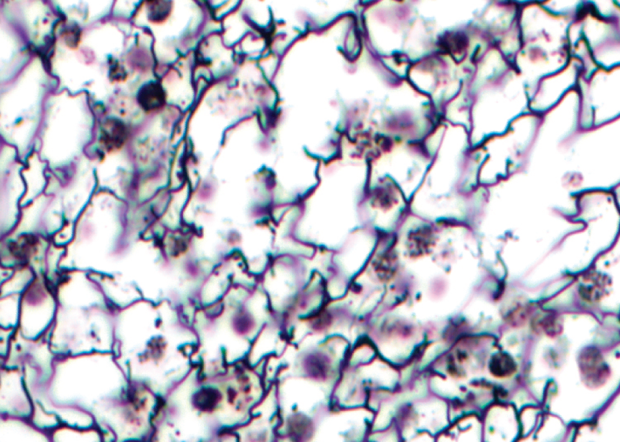 <p><span>Reticular Connective Tissue</span></p>