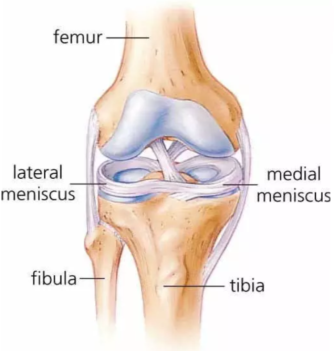 <p>Fibrocartilage spacers removed during TKA.</p>