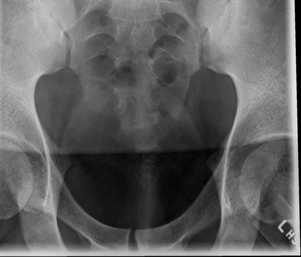 <p>critique this coccyx AP axial</p>