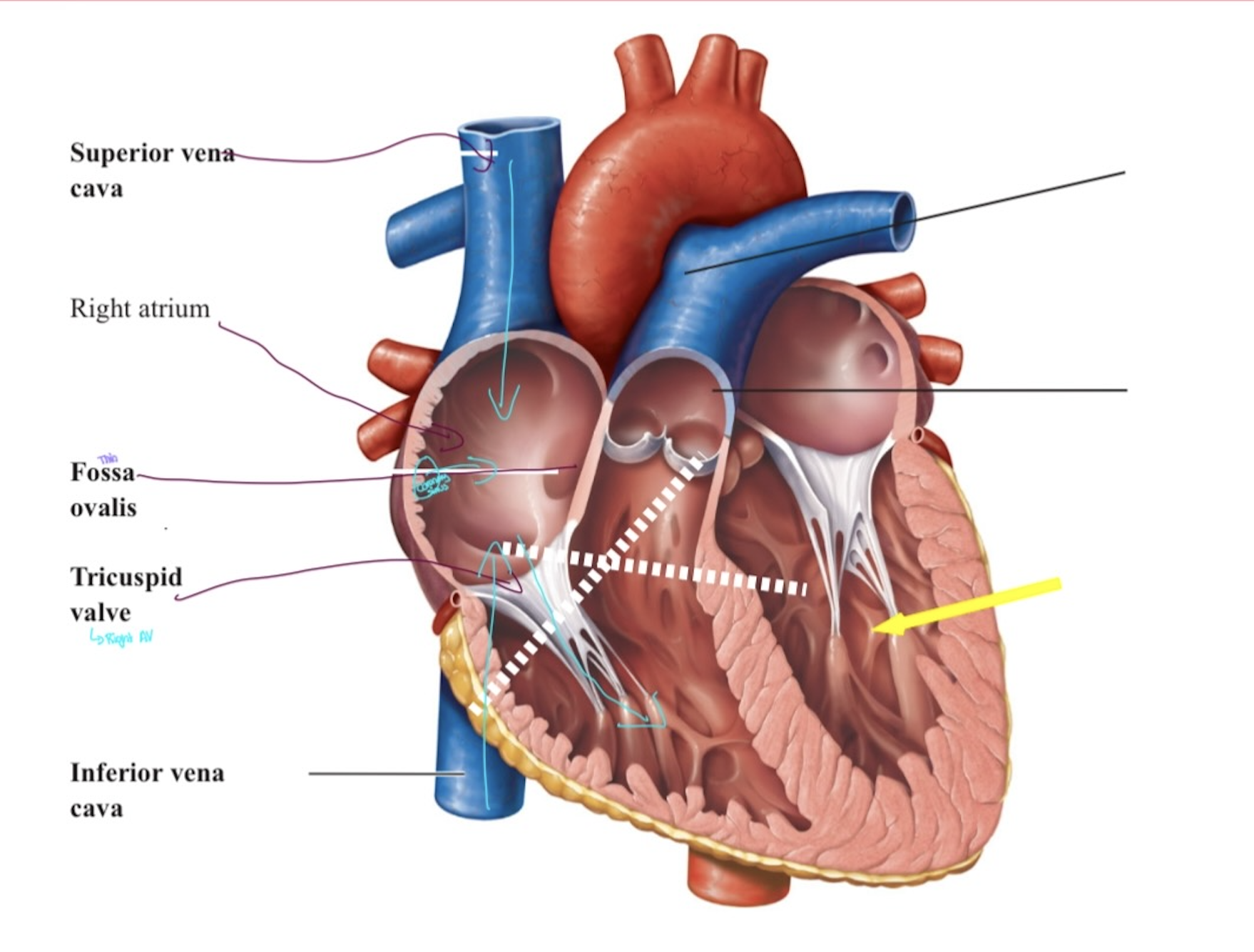 <ul><li><p><span>Blood is received from the <strong>venous systemic</strong> circulation by the<strong> right<br>atrium</strong></span></p><ul><li><p><span>3 vessels empty into the right atria: <strong>superior vena cava, inferior vena cava, </strong>and the<strong> coronary sinus</strong></span></p></li></ul><p></p></li><li><p><span><strong> Intratrial septum</strong></span></p><ul><li><p><span> is the thin wall between the atria</span></p></li></ul></li></ul><p></p><ul><li><p><strong>Fossa ovalis </strong></p><ul><li><p><span>depression in intratrial septum </span></p></li><li><p><span>was a hole from the fetal period that closed.</span></p></li></ul></li></ul><p></p><ul><li><p><span>Blood leaves the R. atria through the <strong>atrioventricular (AV) opening</strong><br>when the <strong>AV valve </strong>(sometimes called <strong>tricuspid valve</strong>) opens.<br></span></p></li></ul><p></p>