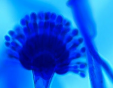 <p>Circumferential phialides, looks like peacockās tail</p>