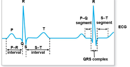 <p><span>Describe the typical ECG output. What is the name of each wave and what does each wave signify?</span></p>