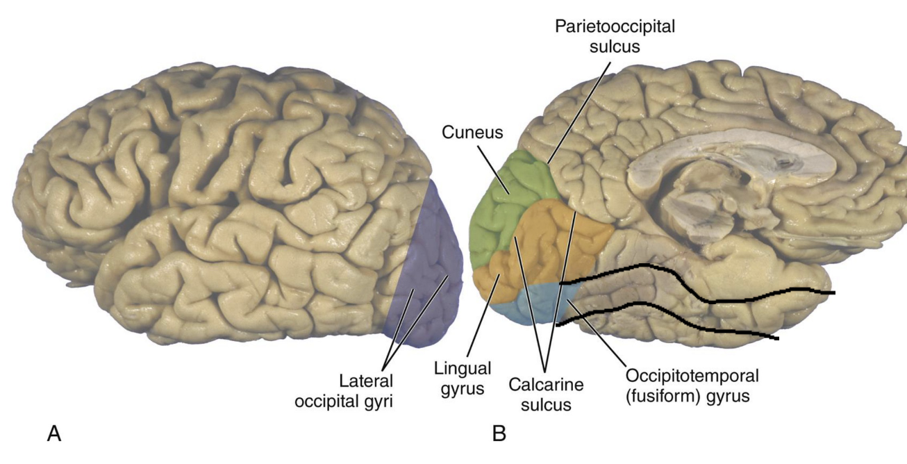 <p>Label Occipital Lobe</p><p>Medial View</p>