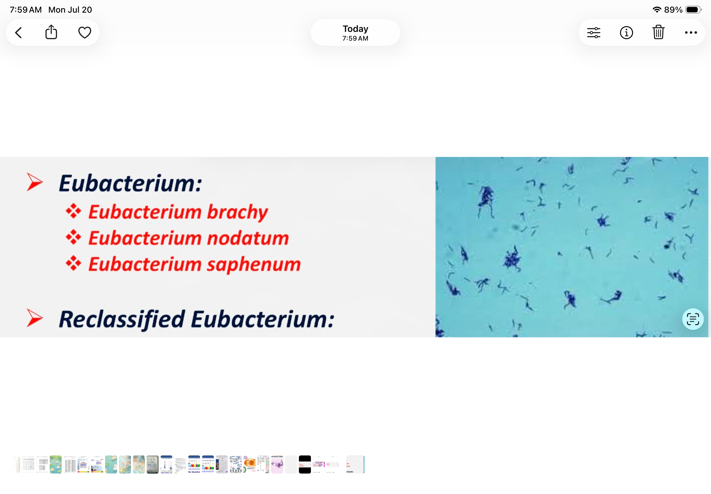 <p>gram positive, rods, anaerobic. Associated with disease</p>