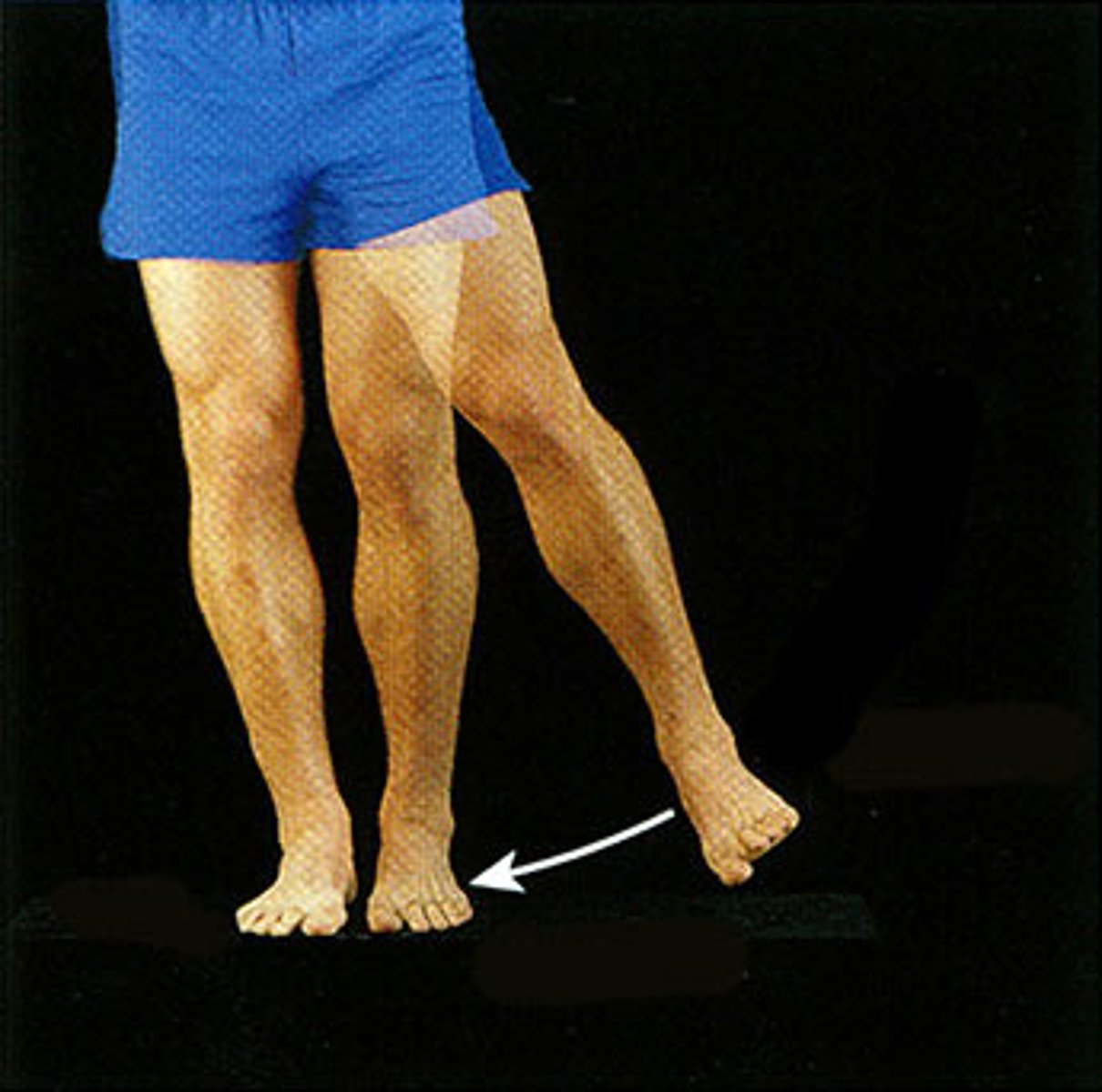 <p>Movement.towards the midline</p>