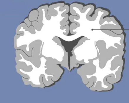 <p>What brain part is this?</p>