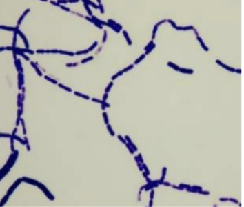 <p>Gram and morphology of this bacteria: purple stained bacteria with a rod-shaped morphology.</p>