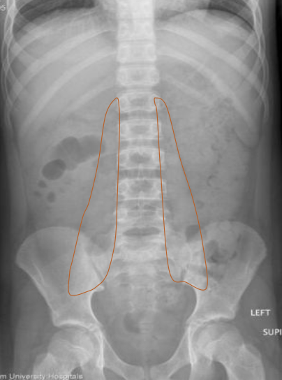 <p>What anatomy is outlined in this image?</p>