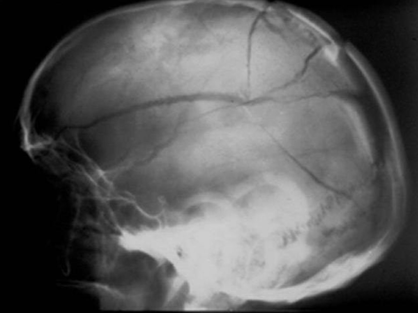 <p>What is the diagnosis?</p>