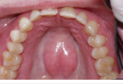 <p>torus (plural, tori)</p>