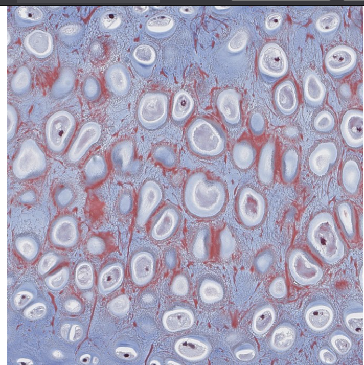 <p>which type of CT is this?</p>