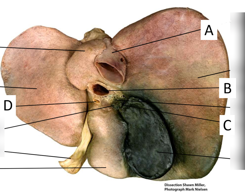 <p>A</p>