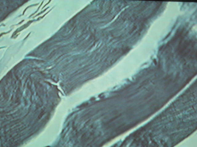 <p>What are the unique characteristics of this tissue?</p>