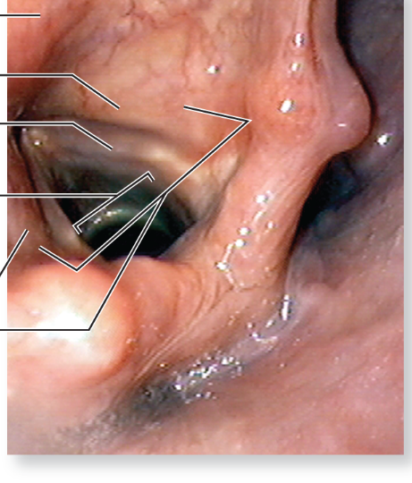 <p>What is pictured</p>