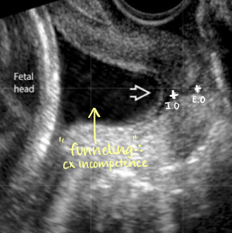 <p>incompetence </p>