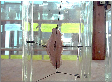 <p>Questions</p><ol><li><p>What is the specimen being examined?</p></li><li><p>What are the descriptive features of the injury on the skin?</p></li><li><p>What is the likely causative instrument for this type of injury?</p></li><li><p>How is the time of death estimated in relation to the injury?</p></li><li><p>What are the possible causes of death?</p></li><li><p>What is the final diagnosis for this specimen?</p></li></ol><div data-type="horizontalRule"><hr></div><p></p>