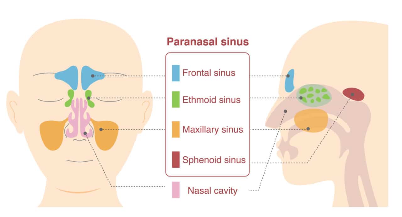 <p>frontal sinus - on forehead </p><p>ethmoid sinus - on sides of bridge of nose </p><p>maxillary sinus - on cheeks beside nose</p><p>sphenoid sinus - behind eyes</p>