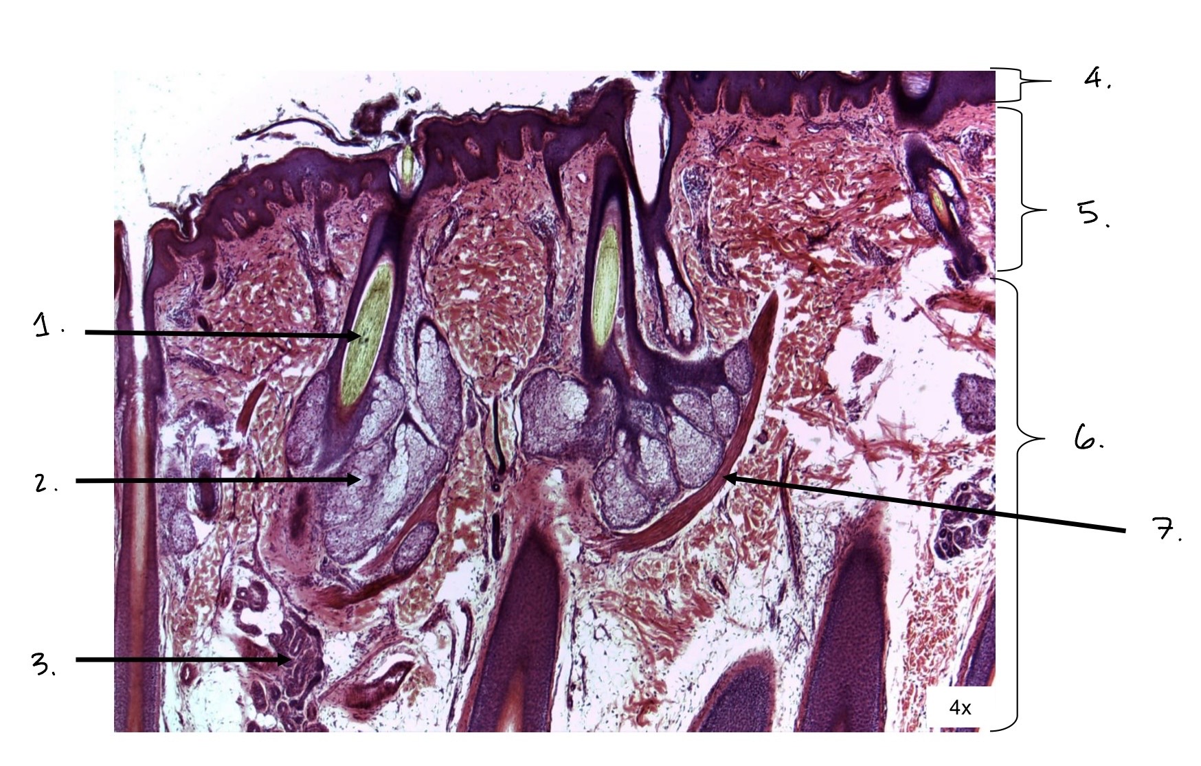 term image