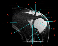 <p>What is labeled 1?</p>