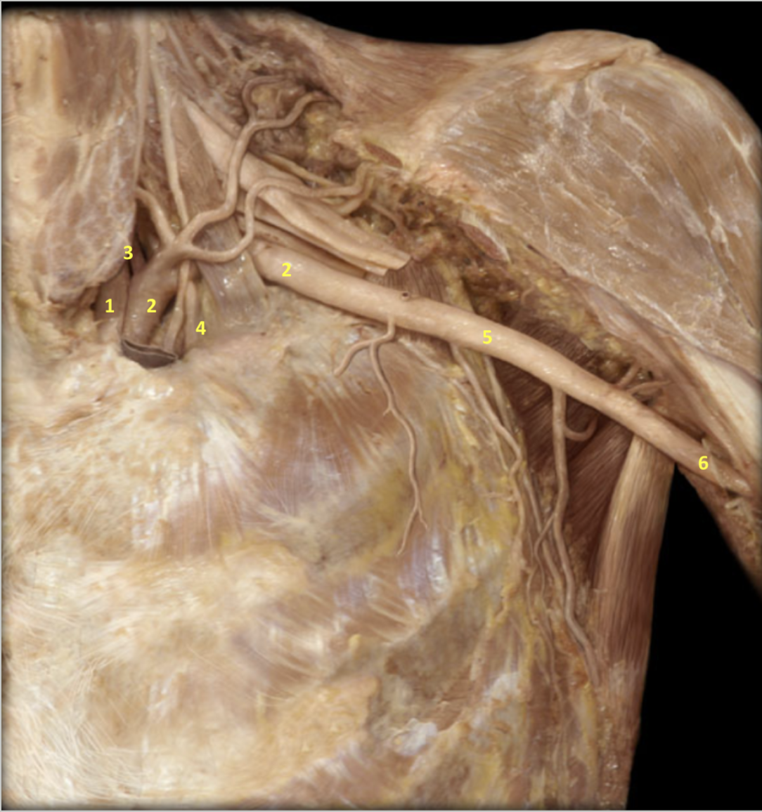 <p>Shoulder - Deeper Dissection</p><p>1. Left common carotid artery</p><p>2. Left subclavian artery</p><p>3. Left vertebral artery</p><p>4. Left internal thoracic artery</p><p>5. Left axillary artery</p><p>6. Left brachial artery</p><p></p>