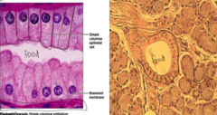 <p>Where is simple columnar located?</p>