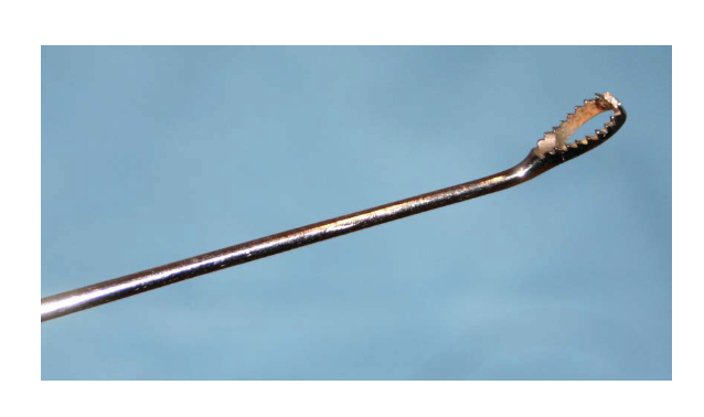 <p>Endocervical Curette</p>