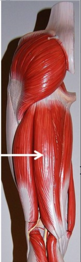 <p>origin: ischial tuberosity insertion: proximal end of the tibia below medial condyle</p>