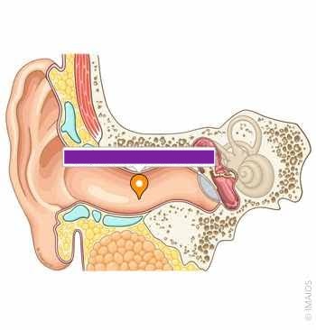 <p>passageway. probe through earhole inside earhole</p>