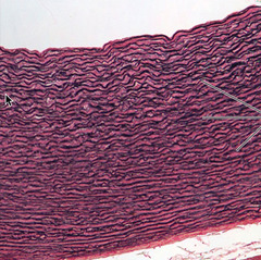 <p>takes up so much dye looks like purple squiggly lines</p><p>--------------------------------</p>