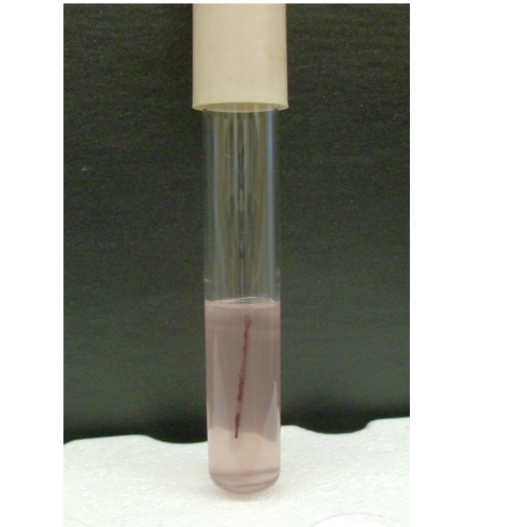 <p>what is the test and result?</p>