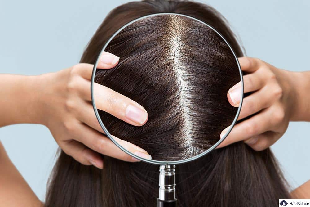 <p>______ hair exhibits continuous growth (Ex: human head hair)</p>