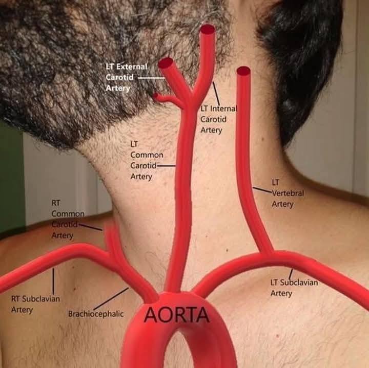 <p>left upper limb</p>