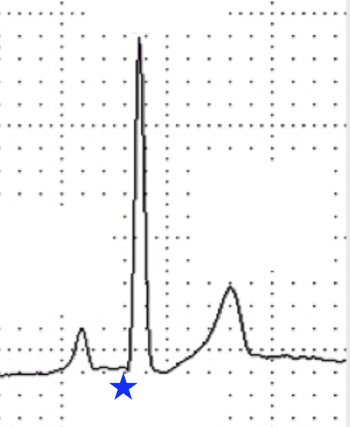 <p>What wave is indicated by the blue star?</p>