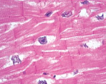 <p>What muscle is this?</p>