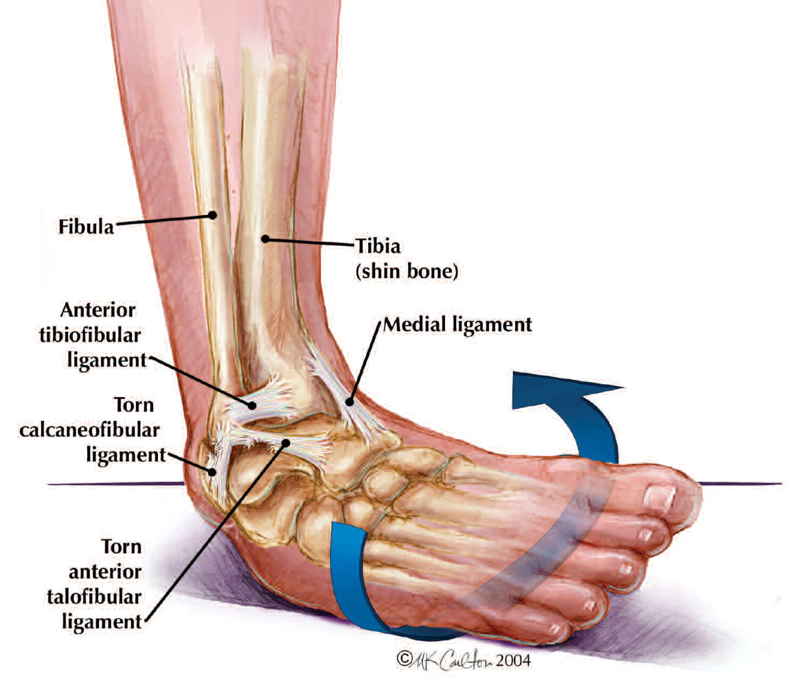 <p>What injury / condition? </p>