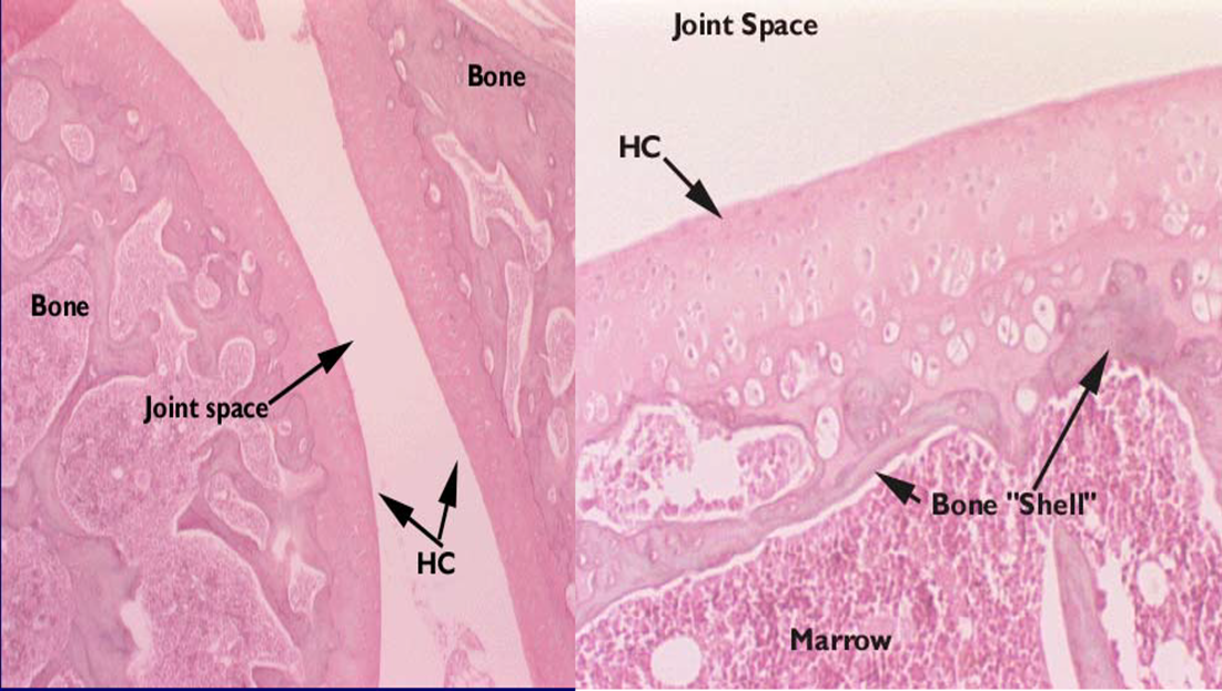 <p>Articular cartilage</p>