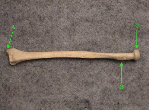 <p>What is the correct term for a movement in which the lateral edge of the foot is raised/lifted?</p>